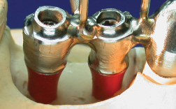 implant cases